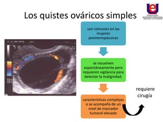 Los quistes ováricos simples
son comunes en las
mujeres
posmenopáusicas
se resuelven
espontáneamente pero
requieren vigilancia para
detectar la malignidad.
características complejas
o se acompaña de un
nivel de marcador
tumoral elevado
requiere
cirugía
 