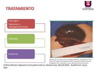 Quirurgico
Detorsion vs
salpingooforectomia
Viabilidad
Conservar
G.Muto Michael. Approach to the patient with an adnexal mass. May 04.2016. Avaible from: Up to
date.
 