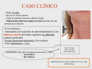 CASO CLÍNICO
- EF sin hallazgos
- Adenopatía cervical dcha de aproximadamente 2 cm
dolorosa, móvil, de bordes regulares no...