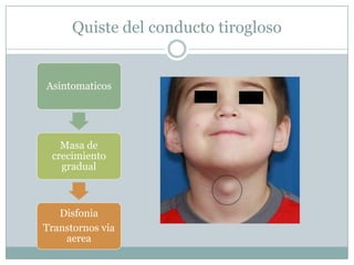 Quiste del conducto tirogloso


Asintomaticos




   Masa de
 crecimiento
   gradual



   Disfonia
Transtornos via
    aerea
 