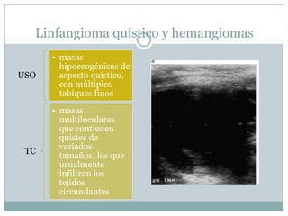 Linfangioma quístico y hemangiomas
      • masas
        hipoecogénicas de
USO     aspecto quístico,
        con múltiples
        tabiques finos
      • masas
        multiloculares
        que contienen
        quistes de
        variados
 TC
        tamaños, los que
        usualmente
        infiltran los
        tejidos
        circundantes
 
