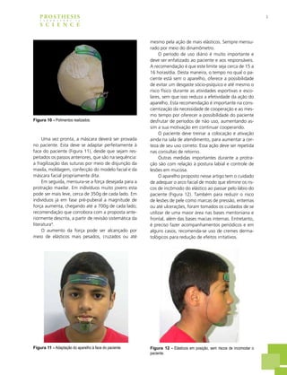 5PROSTHESIS
S C I E N C E
L A B O R A T O R Y i n
Uma vez pronta, a máscara deverá ser provada
no paciente. Esta deve se adaptar perfeitamente à
face do paciente (Figura 11), desde que sejam res-
peitados os passos anteriores, que são na sequência:
a fragilização das suturas por meio de disjunção da
maxila, moldagem, confecção do modelo facial e da
máscara facial propriamente dita.
Em seguida, mensura-se a força desejada para a
protração maxilar. Em indivíduos muito jovens esta
pode ser mais leve, cerca de 350g de cada lado. Em
indivíduos já em fase pré-puberal a magnitude de
força aumenta, chegando até a 700g de cada lado;
recomendação que corrobora com a proposta ante-
riormente descrita, a partir de revisão sistemática da
literatura4
.
O aumento da força pode ser alcançado por
meio de elásticos mais pesados, cruzados ou até
Figura 10 - Polimentos realizados.
mesmo pela ação de mais elásticos. Sempre mensu-
rado por meio do dinamômetro.
O período de uso diário é muito importante e
deve ser enfatizado ao paciente e aos responsáveis.
A recomendação é que este limite seja cerca de 15 a
16 horas/dia. Desta maneira, o tempo no qual o pa-
ciente está sem o aparelho, oferece a possibilidade
de evitar um desgaste sócio-psíquico e até mesmo o
risco físico durante as atividades esportivas e esco-
lares, sem que isso reduza a efetividade da ação do
aparelho. Esta recomendação é importante na cons-
cientização da necessidade de cooperação e ao mes-
mo tempo por oferecer a possibilidade do paciente
desfrutar de períodos de não uso, aumentando as-
sim a sua motivação em continuar cooperando.
O paciente deve treinar a colocação e ativação
ainda na sala de atendimento, para aumentar a cer-
teza de seu uso correto. Essa ação deve ser repetida
nas consultas de retorno.
Outras medidas importantes durante a protra-
ção são com relação à postura labial e controle de
lesões em mucosa.
O aparelho proposto nesse artigo tem o cuidado
de adequar o arco facial de modo que elimine os ris-
cos de incômodo do elástico ao passar pelo lábio do
paciente (Figura 12). Também para reduzir o risco
de lesões de pele como marcas de pressão, eritemas
ou até ulcerações, foram tomados os cuidados de se
utilizar de uma maior área nas bases mentoniana e
frontal, além das bases macias internas. Entretanto,
é preciso fazer acompanhamentos periódicos e em
alguns casos, recomenda-se uso de cremes derma-
tológicos para redução de efeitos irritativos.
Figura 11 - Adaptação do aparelho à face do paciente. Figura 12 - Elásticos em posição, sem riscos de incomodar o
paciente.
 