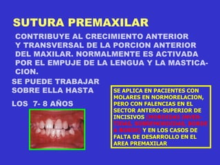 SUTURA PREMAXILAR CONTRIBUYE AL CRECIMIENTO ANTERIOR  Y TRANSVERSAL DE LA PORCION ANTERIOR DEL MAXILAR. NORMALMENTE ES ACTIVADA POR EL EMPUJE DE LA LENGUA Y LA MASTICA- CION. SE PUEDE TRABAJAR SOBRE ELLA HASTA  LOS  7- 8 AÑOS SE APLICA EN PACIENTES CON MOLARES EN NORMORELACION, PERO CON FALENCIAS EN EL SECTOR ANTERO-SUPERIOR DE INCISIVOS  (MORDIDAS INVER- TIDAS, SOBREMORDIDAS, BORDE A BORDE)  Y EN LOS CASOS DE FALTA DE DESARROLLO EN EL AREA PREMAXILAR 