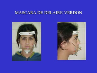 MASCARA DE DELAIRE-VERDON 
