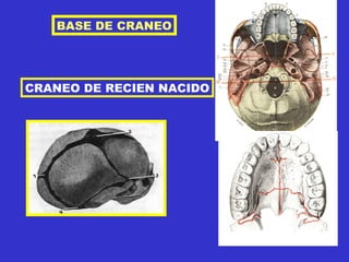 BASE DE CRANEO CRANEO DE RECIEN NACIDO 