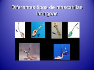 Diferentes tipos de mascarillasDiferentes tipos de mascarillas
laríngeaslaríngeas
 