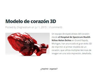 ¿imprimir organos?
 