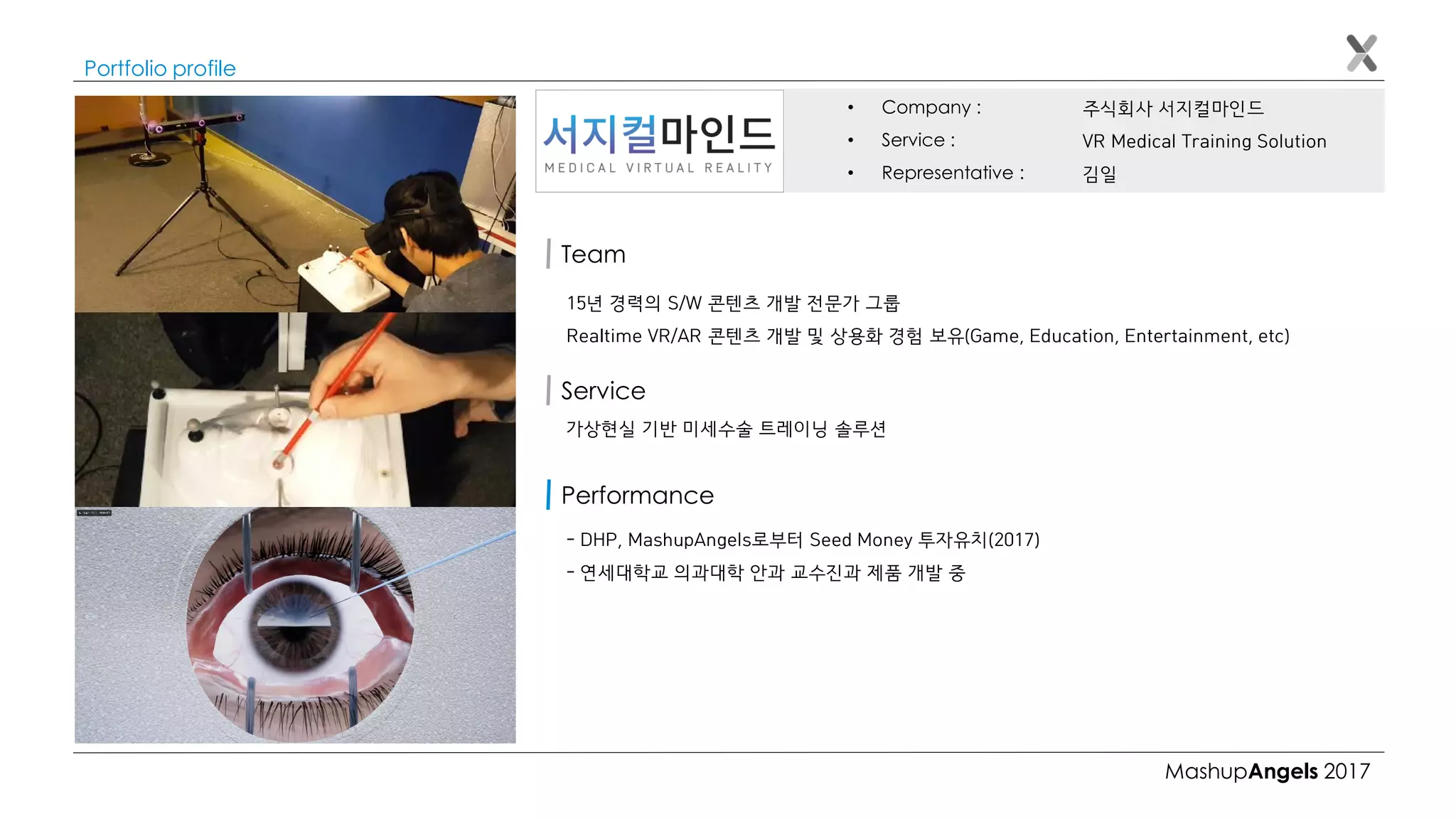 MashupAngels 2017
Portfolio profile
주식회사 서지컬마인드
VR Medical Training Solution
김일
• Company :
• Service :
• Representative :
Team
15년 경력의 S/W 콘텐츠 개발 전문가 그룹
Realtime VR/AR 콘텐츠 개발 및 상용화 경험 보유(Game, Education, Entertainment, etc)
가상현실 기반 미세수술 트레이닝 솔루션
Service
- DHP, MashupAngels로부터 Seed Money 투자유치(2017)
- 연세대학교 의과대학 안과 교수진과 제품 개발 중
Performance
 