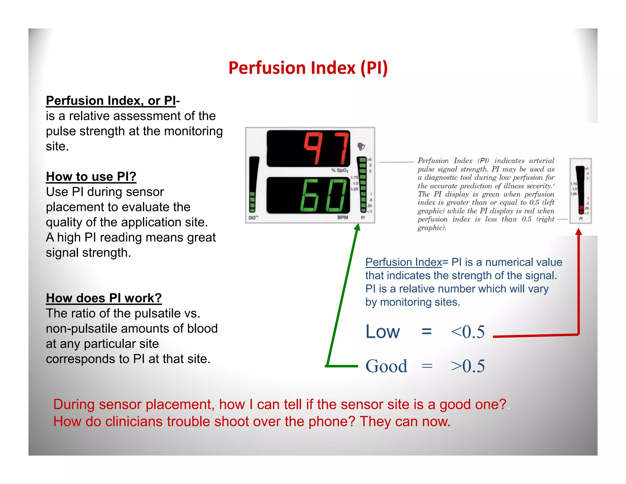 Perfusion Index (PI)
Perfusion Index, or PI-
is a relative assessment of the
pulse strength at the monitoring
site.

How to use PI?
Use PI during sensor
placement to evaluate the
quality of the application site.
A high PI reading means great
signal strength.
                                                    Perfusion Index= PI is a numerical value
                                                    that indicates the strength of the signal.
                                                    PI is a relative number which will vary
How does PI work?                                   by monitoring sites.
The ratio of the pulsatile vs.
non-pulsatile amounts of blood                      Low        = <0.5
at any particular site
corresponds to PI at that site.
                                                    Good = >0.5
 During sensor placement, how I can tell if the sensor site is a good one?.
 How do clinicians trouble shoot over the phone? They can now.
 