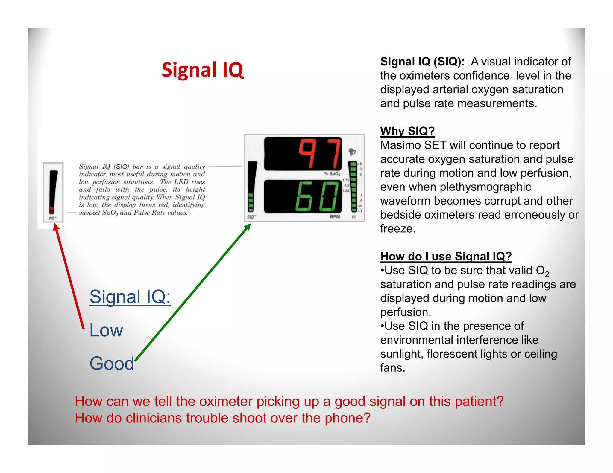Signal IQ (SIQ): A visual indicator of
              Signal IQ                          the oximeters confidence level in the
                                                 displayed arterial oxygen saturation
                                                 and pulse rate measurements.

                                                 Why SIQ?
                                                 Masimo SET will continue to report
                                                 accurate oxygen saturation and pulse
                                                 rate during motion and low perfusion,
                                                 even when plethysmographic
                                                 waveform becomes corrupt and other
                                                 bedside oximeters read erroneously or
                                                 freeze.

                                                 How do I use Signal IQ?
                                                 •Use SIQ to be sure that valid O2
                                                 saturation and pulse rate readings are
  Signal IQ:                                     displayed during motion and low
                                                 perfusion.
                                                 •Use SIQ in the presence of
  Low                                            environmental interference like
                                                 sunlight, florescent lights or ceiling
  Good                                           fans.

How can we tell the oximeter picking up a good signal on this patient?
How do clinicians trouble shoot over the phone?
 