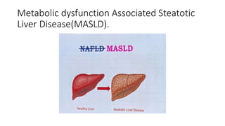 METABOLIC DYSFUNCTION ASSOCIATED STEATOTIC LIVER DISEASE IN ADULTS visual data 5