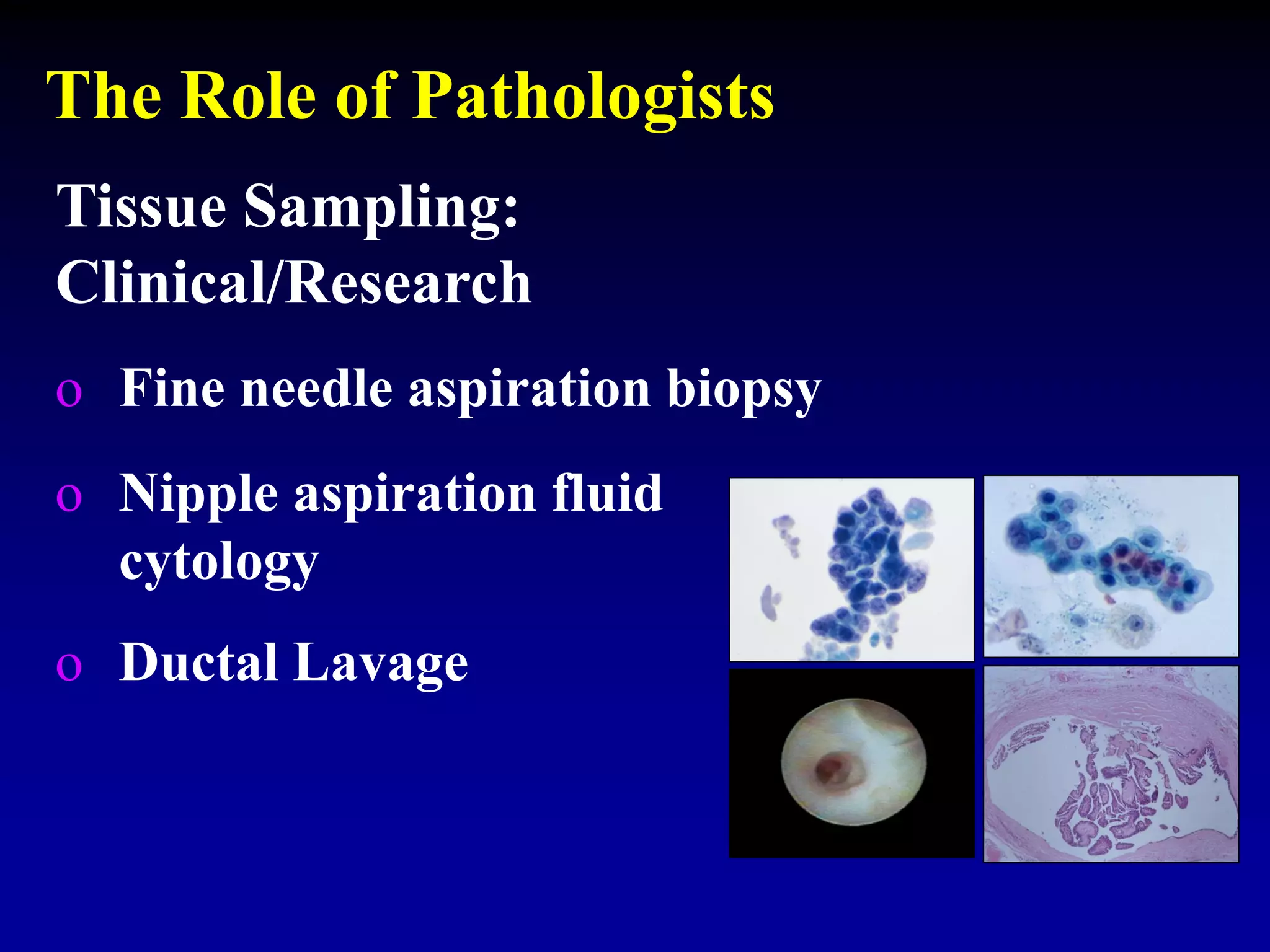 The Role of Pathologists
Tissue Sampling:
Clinical/Research
o Fine needle aspiration biopsy
o Nipple aspiration fluid
cytology
o Ductal Lavage
 