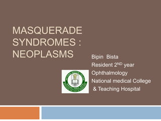 MASQUERADE
SYNDROMES :
NEOPLASMS Bipin Bista
Resident 2ND year
Ophthalmology
National medical College
& Teaching Hospital
 