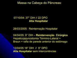 Massa na Cabeça do Pâncreas:



07/10/04: 37° DIH // 22 DPO
            Alta Hospitalar

28/03/2005: Reinternação Hospitalar

04/04/05: 9° DIH – Reintervenção Cirúrgica
Hepaticojejunostomia Término-Lateral +
Braun + rafia de parede anterior do estômago

13/04/05 18° DIH // 9° DPO
Alta Hospitalar sem intercorrências
 