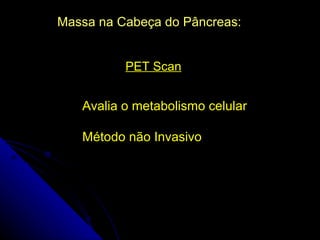 Massa na Cabeça do Pâncreas:


          PET Scan


   Avalia o metabolismo celular

   Método não Invasivo
 
