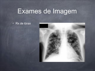 Exames de Imagem
Rx de tórax
 