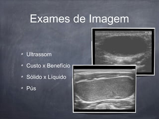Exames de Imagem
Ultrassom
Custo x Benefício
Sólido x Líquido
Pús
 