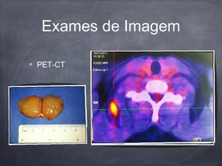 Exames de Imagem
PET-CT
 