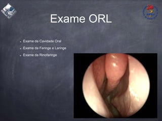 Exame ORL
Exame da Cavidade Oral
Exame da Faringe e Laringe
Exame da Rinofaringe
 