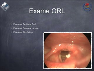 Exame ORL
Exame da Cavidade Oral
Exame da Faringe e Laringe
Exame da Rinofaringe
 