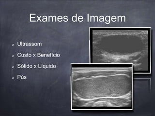 Exames de Imagem
Ultrassom
Custo x Benefício
Sólido x Líquido
Pús
 