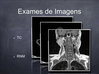 Exames de Imagens
TC
RNM
 
