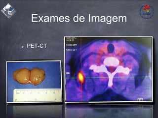 Exames de Imagem
PET-CT
 