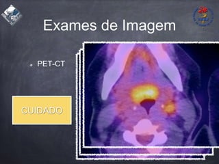 Exames de Imagem
PET-CT
CUIDADO
 