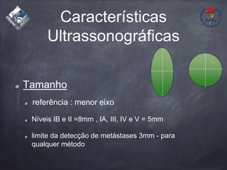 Características
Ultrassonográficas
Tamanho
referência : menor eixo
Níveis IB e II =8mm , IA, III, IV e V = 5mm
limite da detecção de metástases 3mm - para
qualquer método
 