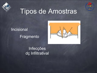Tipos de Amostras
Incisional
Infecções
dç Infiltratival
Fragmento
 