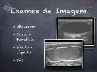 Exames de Imagem
Ultrassom
Custo x
Benefício
Sólido x
Líquido
Pús
 