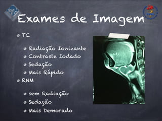 Exames de Imagem
TC
Radiação Ionizante
Contraste Iodado
Sedação
Mais Rápido
RNM
sem Radiação
Sedação
Mais Demorado
 