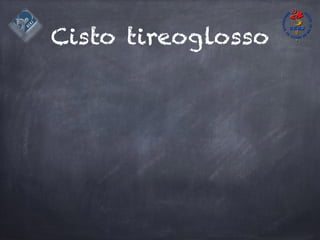 Cisto tireoglosso
 