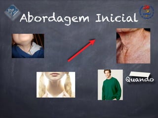 Abordagem Inicial
Quando
 