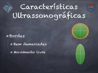 Características
Ultrassonográficas
Bordas
Bem demarcadas
Movimento livre
 