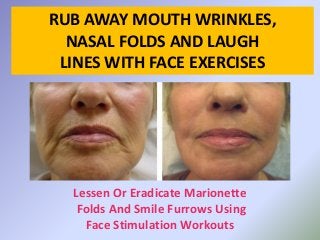 RUB AWAY MOUTH WRINKLES,
NASAL FOLDS AND LAUGH
LINES WITH FACE EXERCISES
Lessen Or Eradicate Marionette
Folds And Smile Furrows Using
Face Stimulation Workouts
 