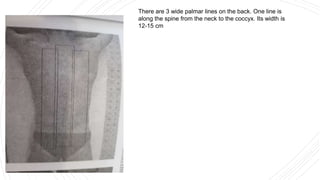 There are 3 wide palmar lines on the back. One line is
along the spine from the neck to the coccyx. Its width is
12-15 cm
 