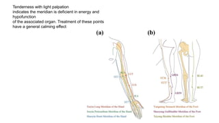Tenderness with light palpation
indicates the meridian is deficient in energy and
hypofunction
of the associated organ. Treatment of these points
have a general calming effect
 