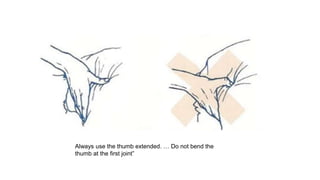 Always use the thumb extended. … Do not bend the
thumb at the first joint”
 
