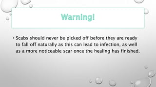 • Scabs should never be picked off before they are ready
to fall off naturally as this can lead to infection, as well
as a more noticeable scar once the healing has finished.
 
