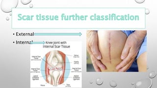 • External
• Internal
 