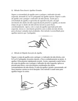b) Método Para Inserir Agulhas Grandes
Segure a extremidade da agulha entre o polegar e indicador da mão
esquerda, deixando 0,2 ou 0,3 polegadas da agulha exposta. Segure o cabo
da agulha com o polegar e indicador da mão direita. Assim que a
extremidade da agulha se aproxima da superfície da pele, um ágil
movimento dos dedos da mão esquerda fazem penetrar a agulha, ao mesmo
tempo em que os dedos da mão direita movem-se para baixo,
coordenadamente. Agora, com o corpo da agulha suportado pela mão
esquerda, inicia-se o movimento giratório com os dedos da mão direita,
para alcançar camadas mais profundas. Este método é aconselhado para
agulhas maiores que 3 polegadas.
c) Método de Rápida Inserção da Agulha
Segure o corpo da agulha com o polegar e o indicador da mão direita, com
0,2 ou 0,3 polegadas, da ponta exposta, e fixe-a cuidadosamente ao ponto. A
agulha é feita penetrar rapidamente na pele. Assim, segurando a parte baixa
do corpo da agulha com o polegar e indicador da mão esquerda, aplica-se
pressão para baixo, com movimentos coordenados dos dedos
correspondentes da mão direita. O cabo da agulha é girado e pressionado, até
fazer penetrar a ponta ao nível desejado. Este método é usado tanto para
agulhas longas ou curtas.
 