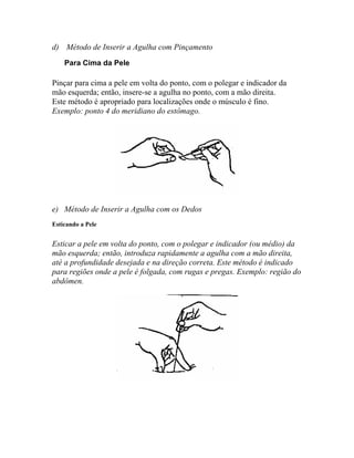 d) Método de Inserir a Agulha com Pinçamento
Para Cima da Pele
Pinçar para cima a pele em volta do ponto, com o polegar e indicador da
mão esquerda; então, insere-se a agulha no ponto, com a mão direita.
Este método é apropriado para localizações onde o músculo é fino.
Exemplo: ponto 4 do meridiano do estômago.
e) Método de Inserir a Agulha com os Dedos
Esticando a Pele
Esticar a pele em volta do ponto, com o polegar e indicador (ou médio) da
mão esquerda; então, introduza rapidamente a agulha com a mão direita,
até a profundidade desejada e na direção correta. Este método é indicado
para regiões onde a pele é folgada, com rugas e pregas. Exemplo: região do
abdômen.
 