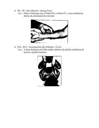 • PG - P6 - Oco Máximo - Krong-Tsoé -
Loc. : Sobre a linha que une o Ponto P5 e o Ponto P7, a cinco distâncias
abaixo da articulação do cotovelo.
• PAs - B13 - Assentamento dos Pulmões - Fei-lu -
Loc.: A duas distâncias da linha média, debaixo da apófise espinhosa da
terceira vértebra torácica.
 