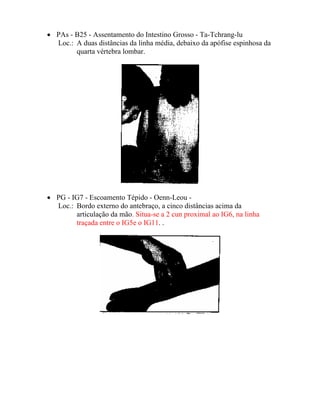 • PAs - B25 - Assentamento do Intestino Grosso - Ta-Tchrang-lu
Loc.: A duas distâncias da linha média, debaixo da apófise espinhosa da
quarta vértebra lombar.
• PG - IG7 - Escoamento Tépido - Oenn-Leou -
Loc.: Bordo externo do antebraço, a cinco distâncias acima da
articulação da mão. Situa-se a 2 cun proximal ao IG6, na linha
traçada entre o IG5e o IG11. .
 