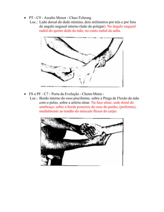 • PT - C9 - Assalto Menor - Chao-Tchrong
Loc.: Lado dorsal do dedo mínimo, dois milímetros por trás e por fora
do angulo ungueal interno (lado do polegar). No ângulo ungueal
radial do quinto dedo da mão, no canto radial da unha.
• FS a PF - C7 - Porta da Evolução - Chenn-Menn -
Loc.: Bordo interno do osso pisciforme, sobre a Prega de Flexão da mão
com o pulso, sobre a artéria ulnar. Na face ulnar, sede distal do
antebraço, sobre a borda posterior do osso do punho, (psiforme),
medialmente ao tendão do músculo flexor do carpo.
 