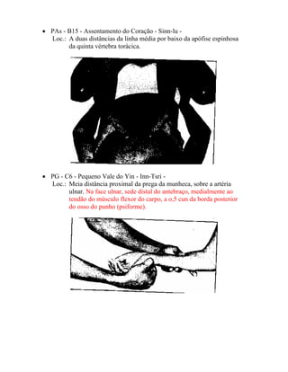 • PAs - B15 - Assentamento do Coração - Sinn-lu -
Loc.: A duas distâncias da linha média por baixo da apófise espinhosa
da quinta vértebra torácica.
• PG - C6 - Pequeno Vale do Yin - Inn-Tsri -
Loc.: Meia distância proximal da prega da munheca, sobre a artéria
ulnar. Na face ulnar, sede distal do antebraço, medialmente ao
tendão do músculo flexor do carpo, a o,5 cun da borda posterior
do osso do punho (psiforme).
 