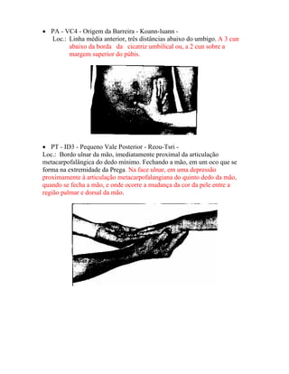 • PA - VC4 - Origem da Barreira - Koann-luann -
Loc.: Linha média anterior, três distâncias abaixo do umbigo. A 3 cun
abaixo da borda da cicatriz umbilical ou, a 2 cun sobre a
margem superior do púbis.
• PT - ID3 - Pequeno Vale Posterior - Reou-Tsri -
Loc.: Bordo ulnar da mão, imediatamente proximal da articulação
metacarpofalângica do dedo mínimo. Fechando a mão, em um oco que se
forma na extremidade da Prega. Na face ulnar, em uma depressão
proximamente à articulação metacarpofalangiana do quinto dedo da mão,
quando se fecha a mão, e onde ocorre a mudança da cor da pele entre a
região palmar e dorsal da mão.
 