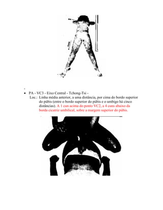 -
• PA - VC3 - Eixo Central - Tchong-Tsi -
Loc.: Linha média anterior, a uma distância, por cima do bordo superior
do púbis (entre o bordo superior do púbis e o umbigo há cinco
distâncias). A 1 cun acima do ponto VC2, a 4 cuns abaixo da
borda cicatriz umbilical, sobre a margem superior do púbis.
 