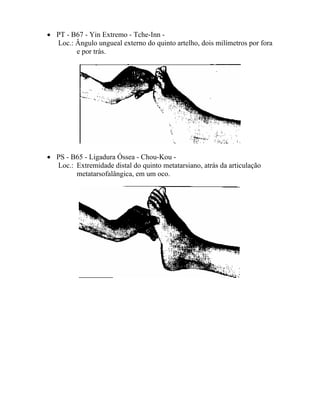 • PT - B67 - Yin Extremo - Tche-Inn -
Loc.: Ângulo ungueal externo do quinto artelho, dois milímetros por fora
e por trás.
• PS - B65 - Ligadura Óssea - Chou-Kou -
Loc.: Extremidade distal do quinto metatarsiano, atrás da articulação
metatarsofalângica, em um oco.
 